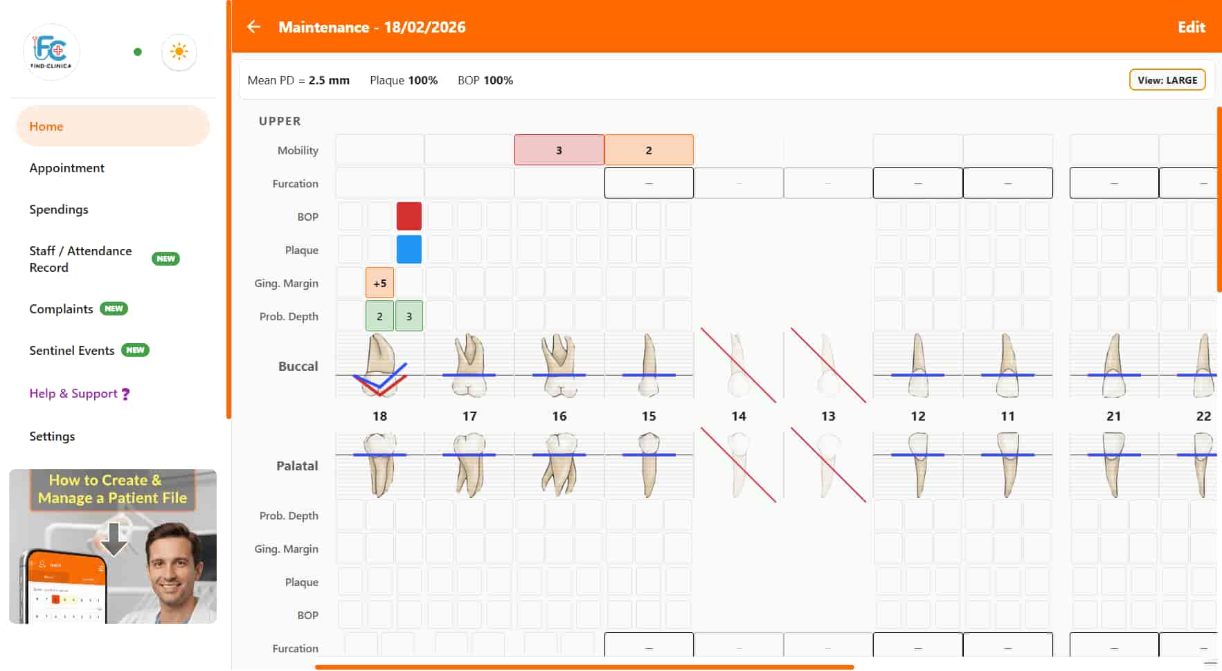 Periodontal chart with probing depths and gingival margins per tooth in the desktop app — FindClinica dentist & medical software