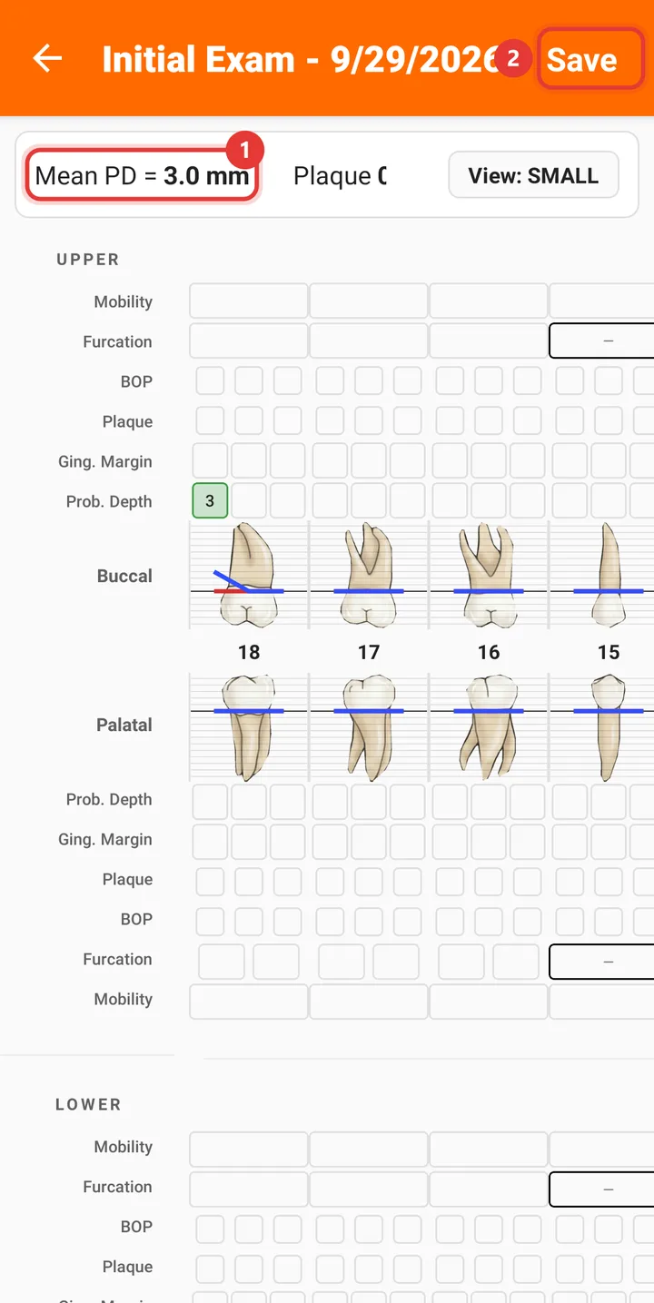 Periodontal chart with Mean PD and the Save button highlighted