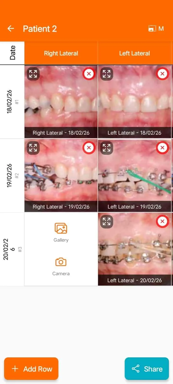 Ortho photo chart on the FindClinica Android app — FindClinica dentist & medical software