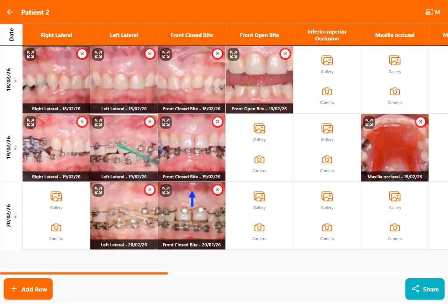 Orthodontic photo chart in FindClinica with lateral, frontal and occlusal views for three visits — FindClinica dentist & medical software
